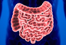 E E S Eryped Erythromycin Ethylsuccinate Dosing Indications