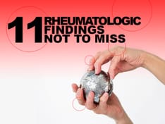 11 Rheumatologic Findings Not to Miss