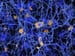 Alzheimer's Disease and Amyloid: Time to Move On?