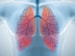 Azithromycin: Hope for Idiopathic Pulmonary Fibrosis?