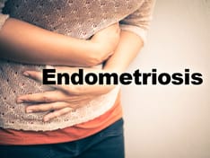 Endometriosis: 5 Things to Know
