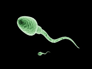 Sperm Count and Motility Declining in United States