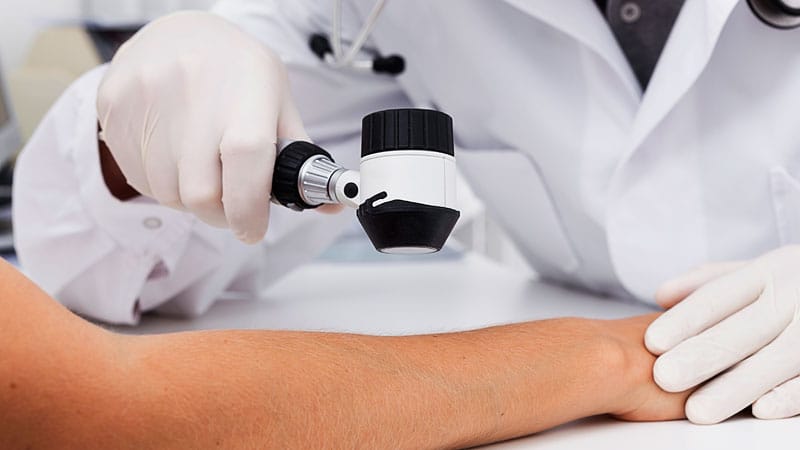 Doctors Warn of Skin Cancer Screening Crisis