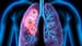 Lorlatinib: Another First-Line Option for ALK-Positive NSCLC?
