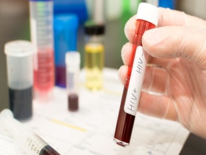 Rethinking the Definition of Cure as Patients With HIV Wait