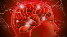 Patients With Epilepsy May Underreport Seizures, Survey Finds