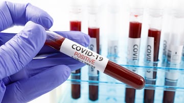 What To Do When Recovered Covid 19 Patients Still Test Positive