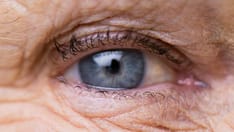 Amyloid in the Retina Correlates With Alzheimer's Brain Changes