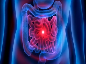 Upadacitinib Shows Positive Endoscopic Outcomes in Crohn's Disease