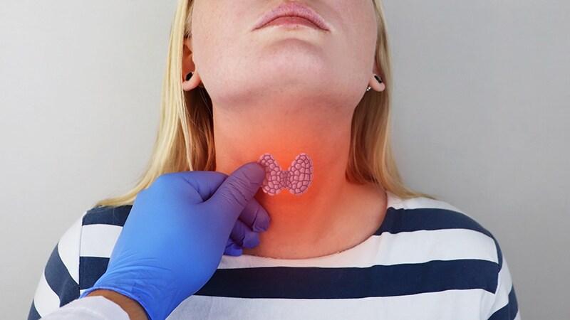 Thyroid Disease | Medscape