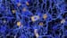 Alzheimer's Association Denies Conflict in Aducanumab Support