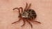 Lyme and Other Tick-Borne Diseases Are on the Rise. But Why?