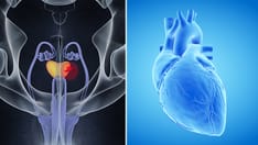 CV Safety Study of Cancer Therapy Attracts Attention