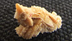 Future 'Exceedingly Bright' for Kidney Stone Prevention