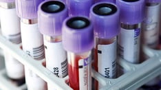 5 Things to Know About Antifungal Therapeutic Drug Monitoring