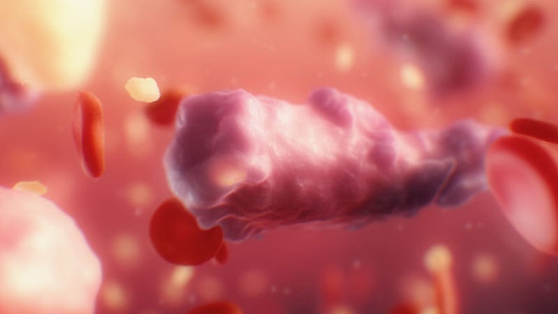 Identifying and Treating ITP