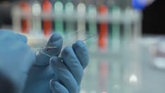 Teamwork: A Multidisciplinary Approach to Early Lung Cancer: Beyond Standard of Care