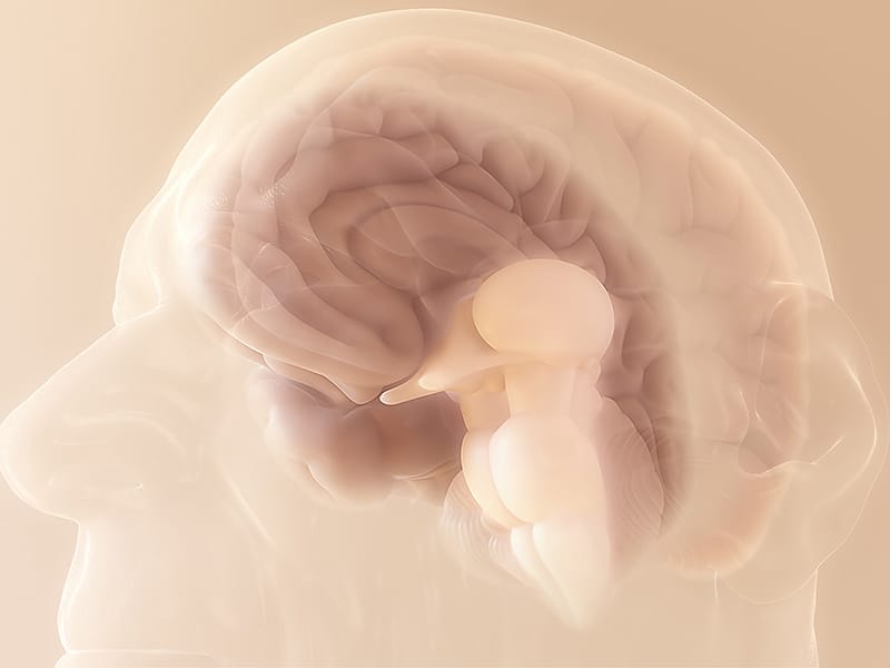 Migraines: A Way Out of the Woods