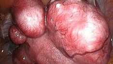 Baby Belly Aches: 7 Causes of Abdominal Pain in Pregnancy