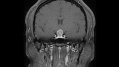 10 Brain Lesions to Recognize