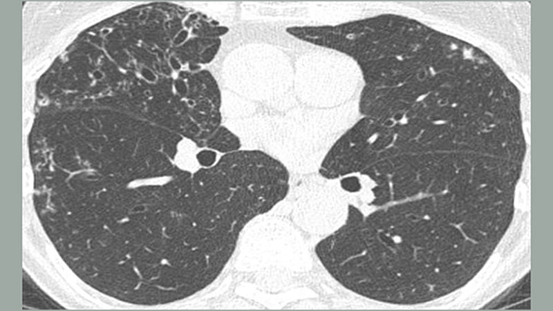 Rheumatology - Medscape