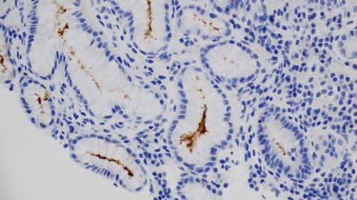 https://img.medscapestatic.com/thumbnail_library/msr_221012_helicobacter_pylori_stain_500x281.jpg