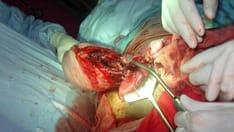 Trauma in Pregnancy: Causes and Types