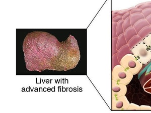 The Liver Meeting 16 American Association For The Study Of Liver Diseases sld