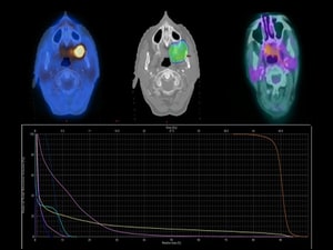 Can Head and Neck Tumor Grade Predict Immunotherapy Response?