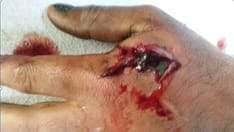 14 Can't-Miss Hand Emergencies