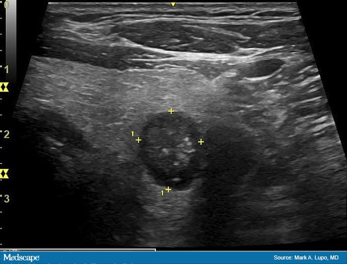 assessing-thyroid-nodules-a-clinician-s-guide-page-2