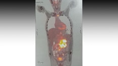 Severe Abdominal Pain and Hematemesis in a 60-Year-Old