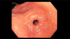 Nausea, Vomiting, and Abdominal Pain in a Cannabis User