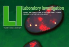 Variant Creutzfeldt Jakob Disease And Bovine Spongiform Encephalopathy Background Pathophysiology And Etiology Epidemiology