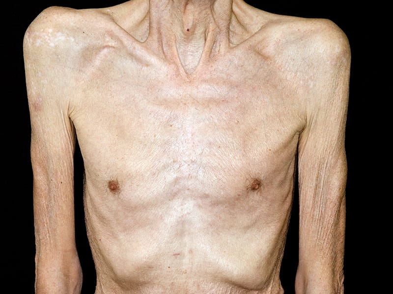 Palliative Care in Oncology Symposium (PCOS) 2015