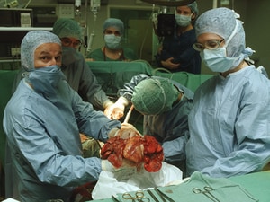 lung transplant surgery