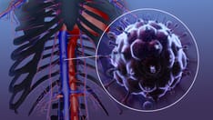 Fast Five Quiz: HIV Recognition and Diagnosis