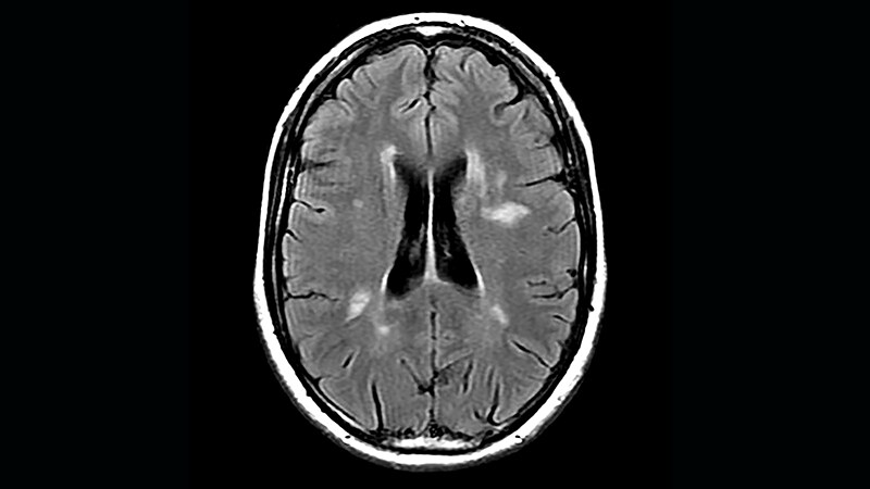 MRI suihin