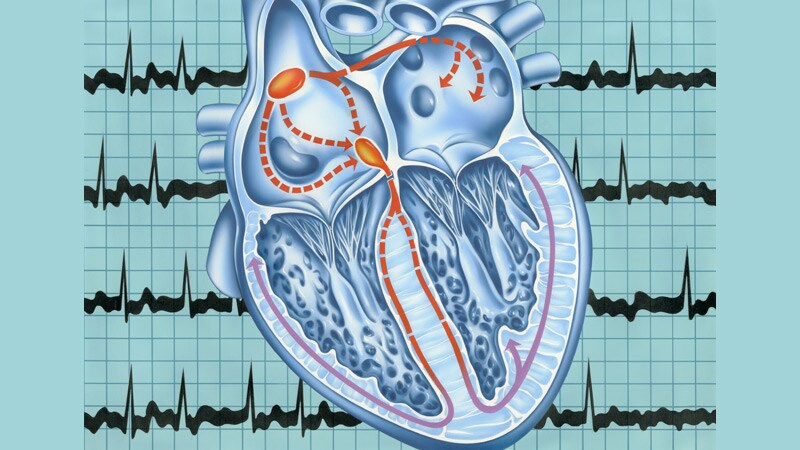 Aspirin To Prevent Stroke In Nonvalvular Atrial Fibrillation - Page 4