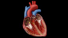 Fast Five Quiz: Atrial Fibrillation and Acute Coronary Syndrome
