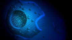 Fast Five Quiz: Lipids Management: High HDL Cholesterol Levels (Hyperalphalipoproteinemia)