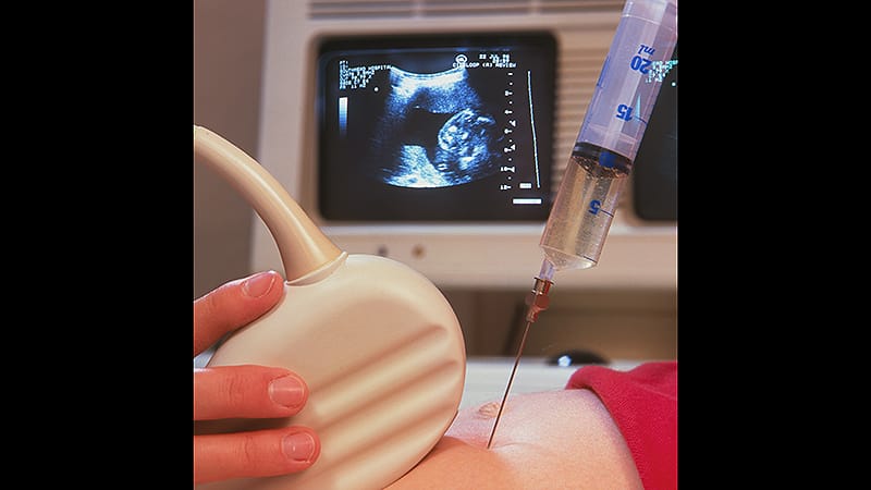 Vaginal Discharge and Fever After Hawaii Trip