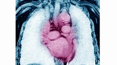 Heart Failure Imaging: Where Are We Now?