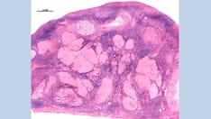 Fast Five Quiz: Menopause