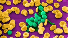 Fast Five Quiz: Staging Chronic Lymphocytic Leukemia