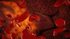 Fast Five Quiz: Sickle Cell Disease Management