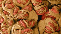 Fact or Fiction: Complement 3 Glomerulopathy