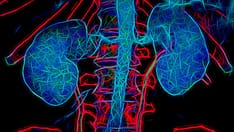 Complement 3 Glomerulopathy: 5 Things to Know