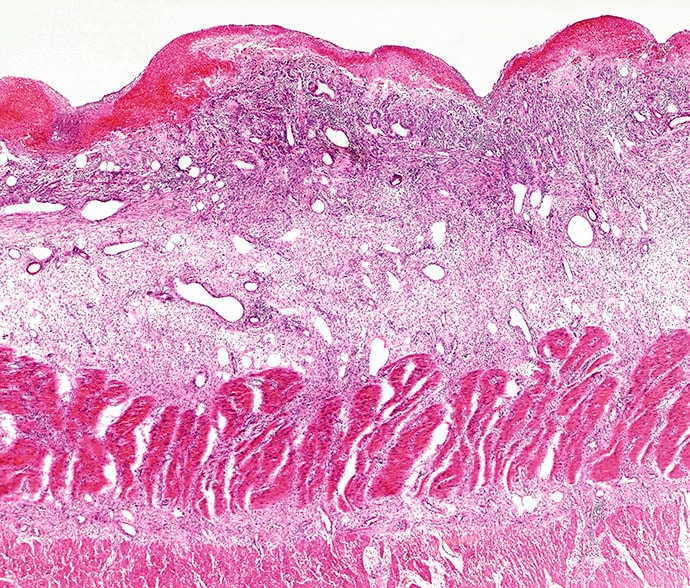 Diarrhea and Chills in a Patient With COPD - Page 3