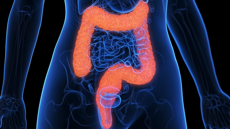 Fast Five Quiz: Ulcerative Colitis Comorbidities